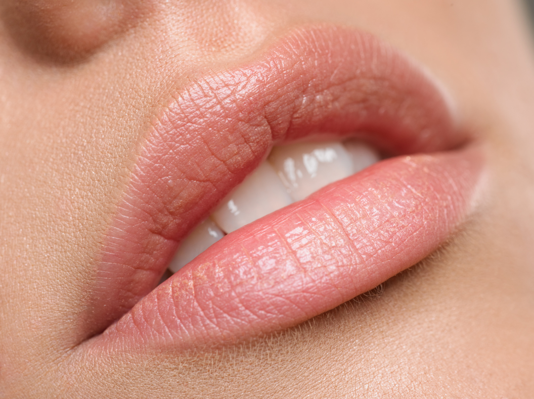 Nahaufnahme von vollen Lippen nach einer Hyaluron Unterspritzung